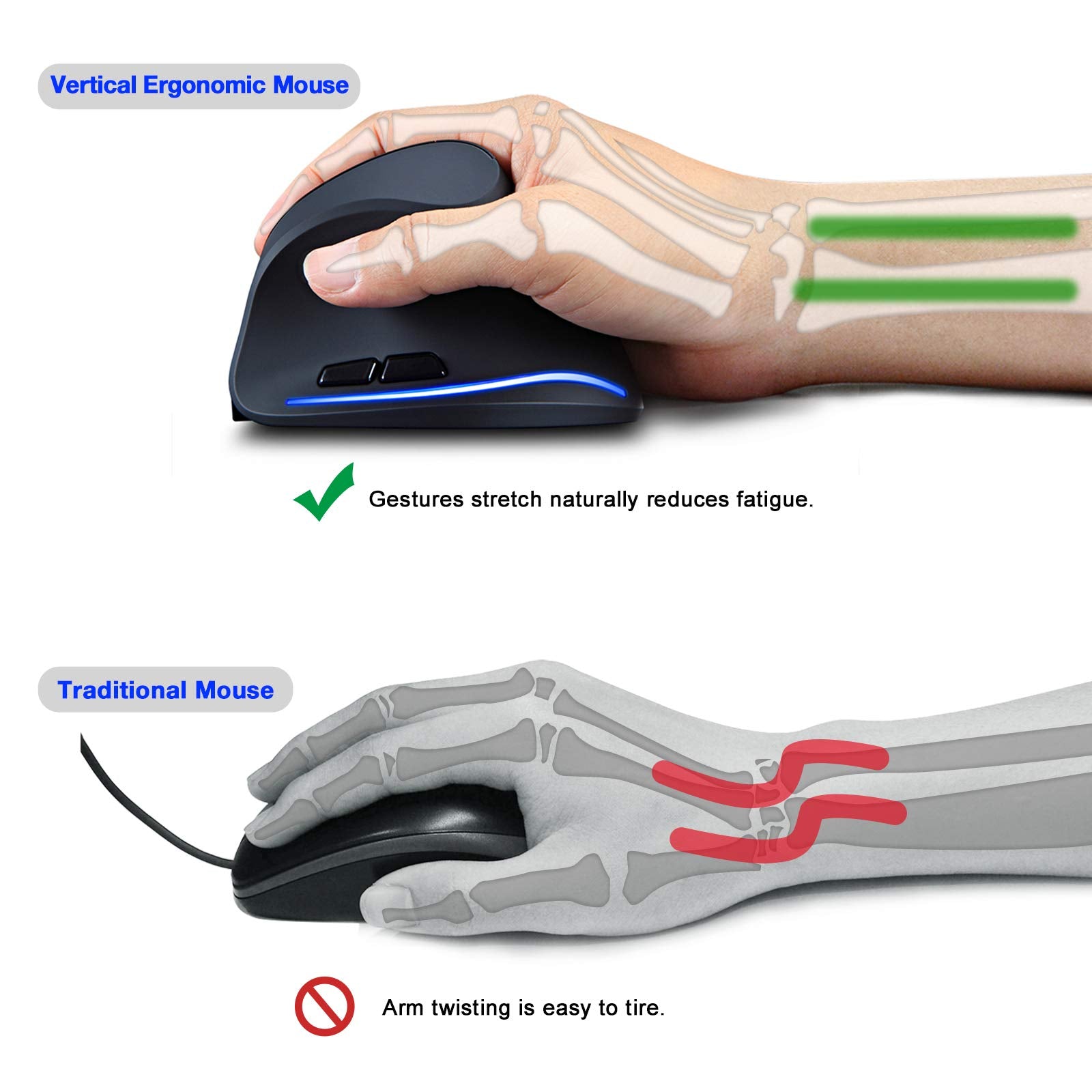 TRELC Ergonomic Mouse, 2.4G Wireless Vertical Optical Mouse with Adjustable Sensitivity (1000/1600/2400 DPI), 6 Buttons for PC, Desktop, Laptop, Notebook (Black)