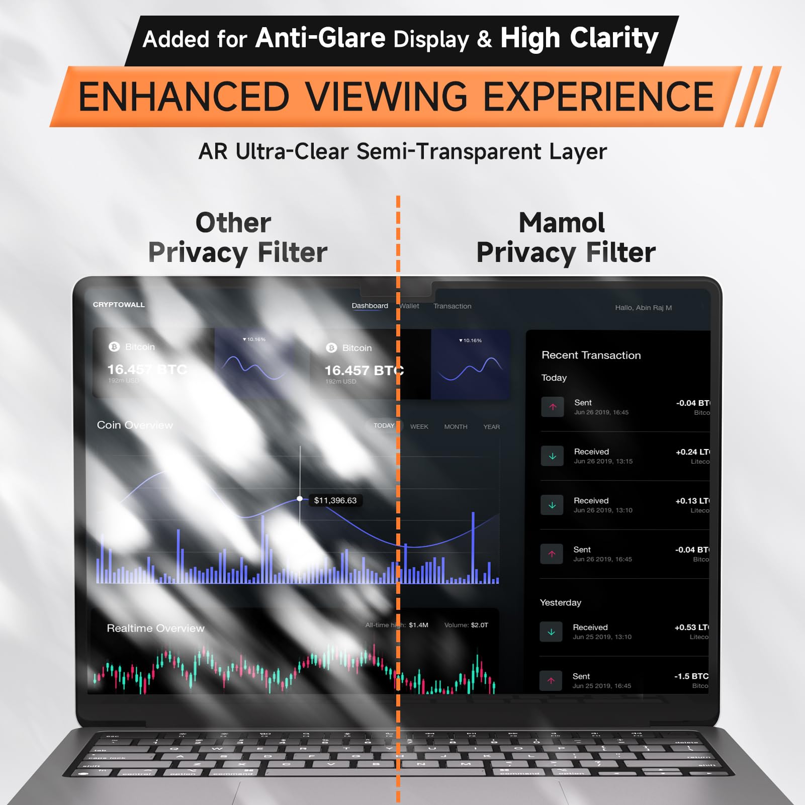 360° Privacy Screen for MacBook Pro 14 Inch (2021-2026, M1, M2, M3, M4, M5, Pro, Max), Anti Glare Blue Light Filter, Nano No Glue Anti Spy Black Protector for Mac Pro 14In Laptop Computer